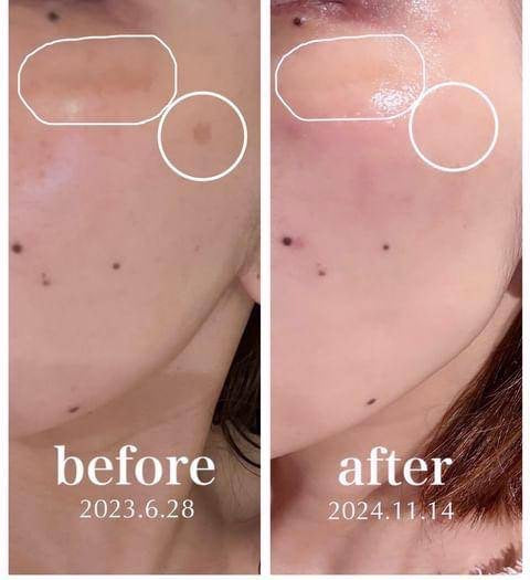 【販売店舗様用】COCO JEWEL SUPER（ココジュエルスーパー） ホワイトニング クリーム M（医薬部外品） 卸売用 SOISHOP