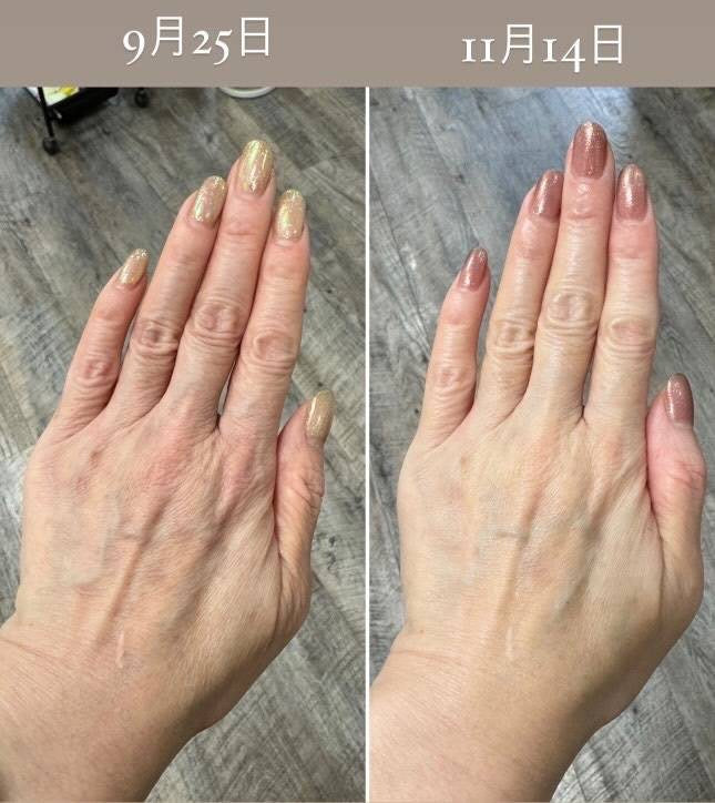 【販売店舗様用】COCO JEWEL SUPER（ココジュエルスーパー） ホワイトニング クリーム M（医薬部外品） 卸売用 SOISHOP